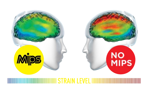 MIPS versus no MIPS: rotational strain on the brain